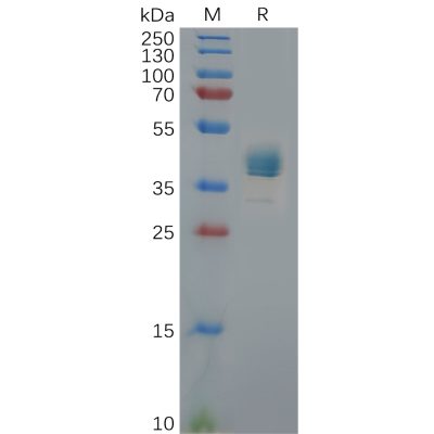 sp-pme100833 cxcr3 sp1