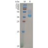 sp-pme100834 cxcr4 sp1