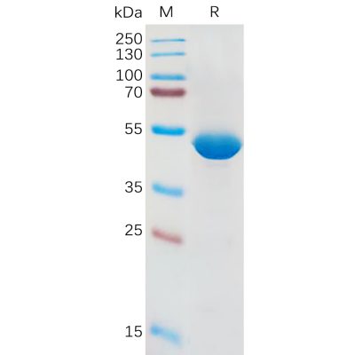 sp-pme100838 il1b sp1
