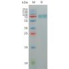 sp-pme100844 kir2dl2 sp1