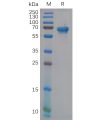 sp-pme100852 ncr1 sp1