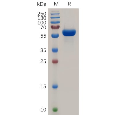 sp-pme100853 tnfrsf11a sp1