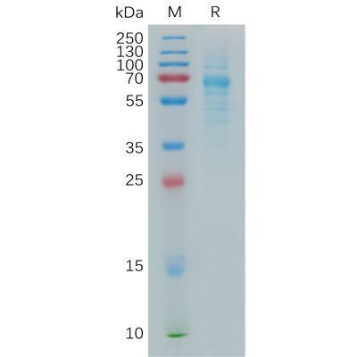 sp-pme100863 colec10 sp1