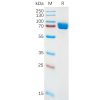 sp-pme100886 il1ra sp1
