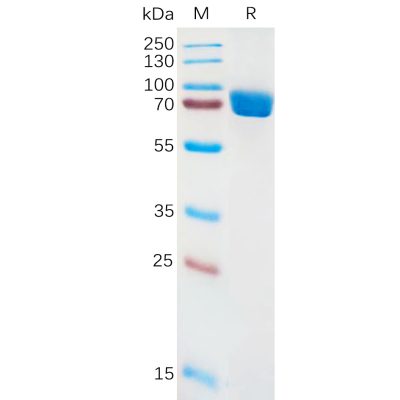 sp-pme100886 il1ra sp1
