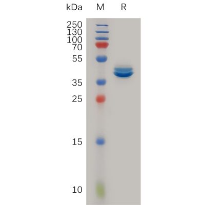 sp-pme100919 ccl2 sp1