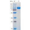 sp-pme100930 gm csfr sp1