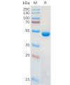 sp-pme100952 lgals1 sp1