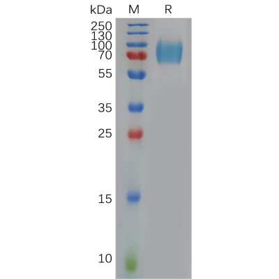 sp-pme100958 ifnar1 sp1