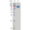 sp-pme100959 ifnar2 sp1