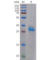 sp-pme100972 lgals3 sp1