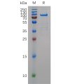 sp-pme100980 mmp11 sp1