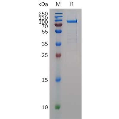 sp-pme100980 mmp11 sp1