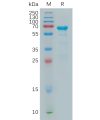 sp-pme100981 mmp2 sp1