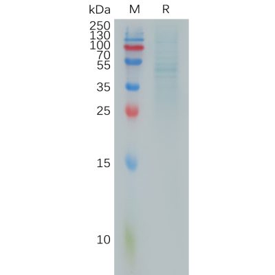 sp-pme101001 rhoc sp1