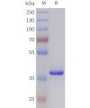 sp-pme101015 tgfb2 sp1