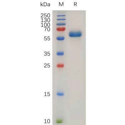 sp-pme101025 tnfrsf1a sp1