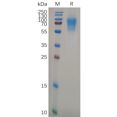 sp-pme101039 cd6 sp1