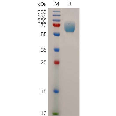 sp-pme101058 ifngr1 sp1