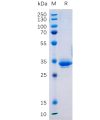 sp-pme101070 tm4sf1 sp1