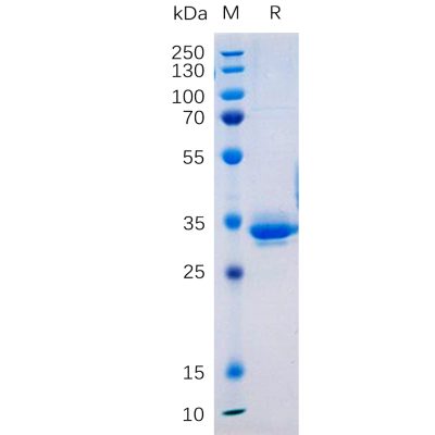 sp-pme101070 tm4sf1 sp1