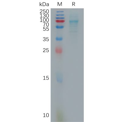 sp-pme101075 cxcl16 sp1