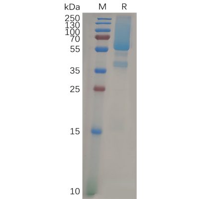 sp-pme101076 gpc1 sp1