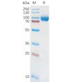 sp-pme101079 il18ra sp1