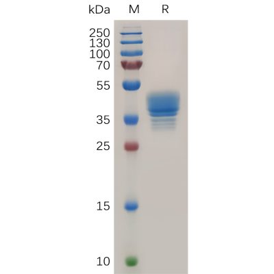 sp-pme101080 ccr3 sp1