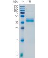 sp-pme101099 scgb2a2 sp1