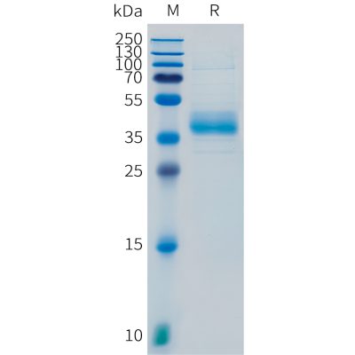 sp-pme101099 scgb2a2 sp1