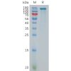 sp-pme101100 enpp3 sp1