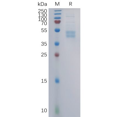 sp-pme101105 ccr6 sp1