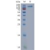 sp-pme101115 osmr sp1