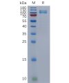 sp-pme101124 npr1 sp1