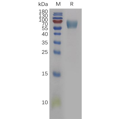 sp-pme101126 il18bp sp1