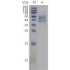 sp-pme101128 il13 sp1