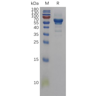 sp-pme101132 areg sp1