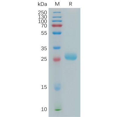 sp-pme101142 btn3a2 sp1