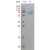 sp-pme101149 fgfr3 sp1
