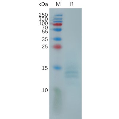 sp-pme101152 a35r sp1