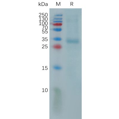 sp-pme101153 prtn3 sp1