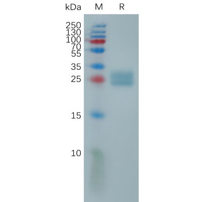 sp-pme101154 ulbp2 sp1