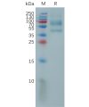 sp-pme101156 il9 sp1