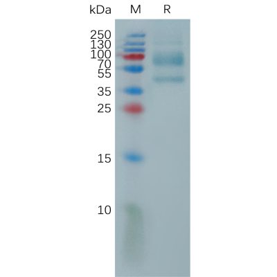 sp-pme101156 il9 sp1