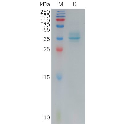 sp-pme101162 agtr1 sp1