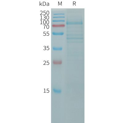 sp-pme101171 cdh11 sp1