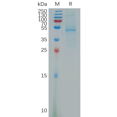 sp-pme101172 pdgfd sp1