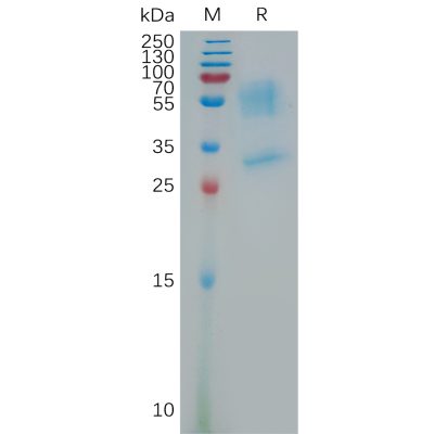 sp-pme101175 prokr1 sp1