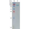 sp-pme101180 fzd7 sp1